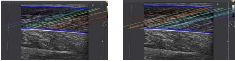 filter fascicles 2
