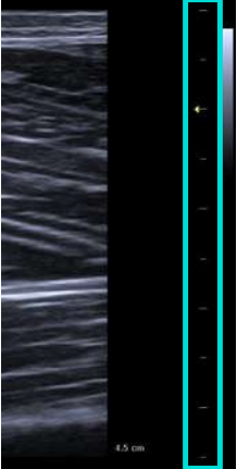 scaling type bar