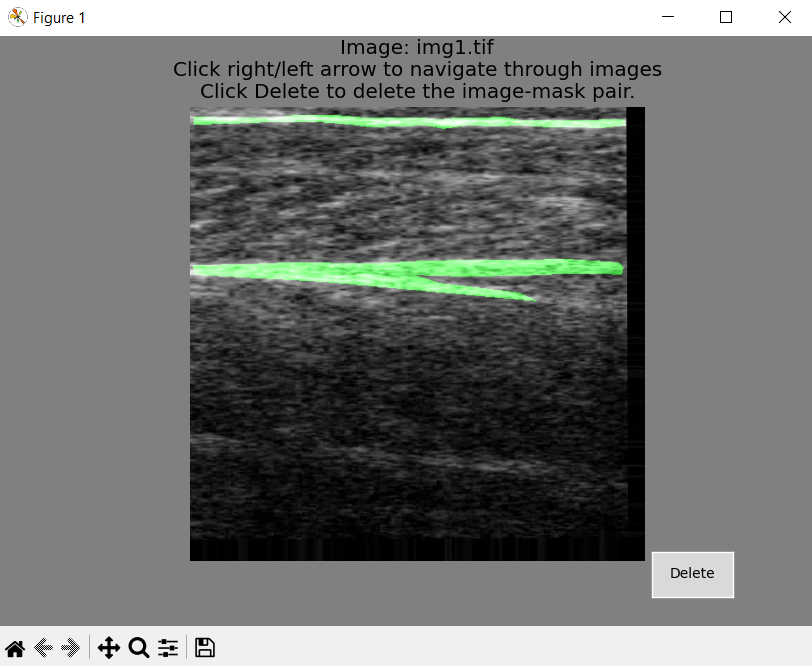 inpsection