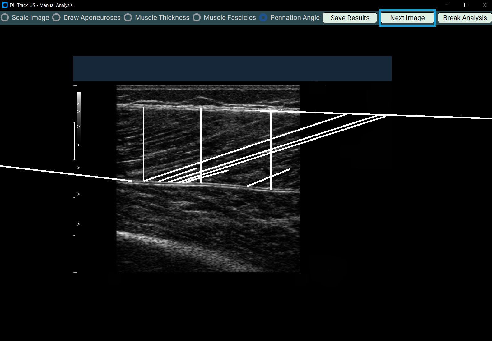 next image