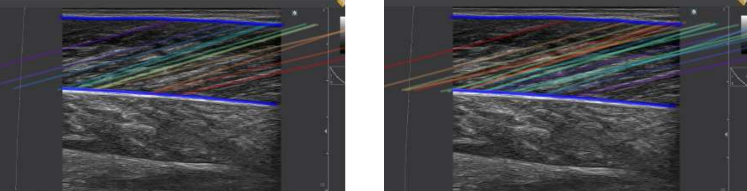 difference filter fasciles
