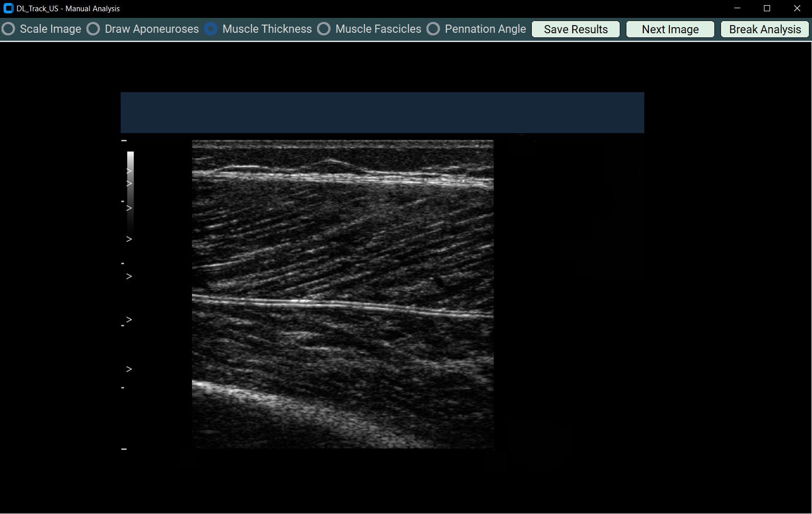 manual analysis window
