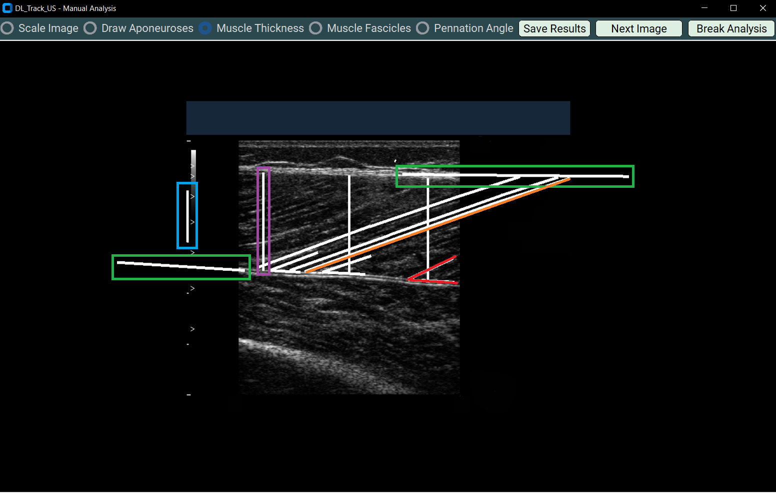 reanalysis